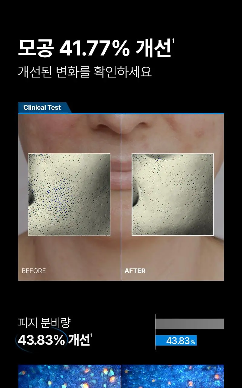 [서인영 디바이스, 모공 수, 모공부위 탄력개선, 300만 플라즈마 샷] 피캄 클리어 프로 상세페이지 15